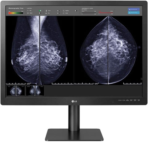 LG 31IN Medical Anti-Glare, 3H DIGNOSTIC Monitor 4200 X 2800 (3:2) Class II FDA
